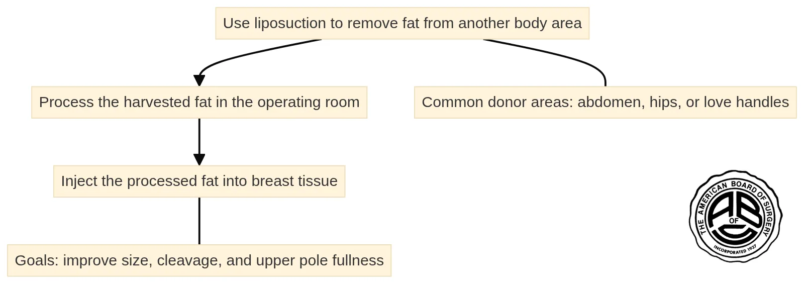 A three-step breast fat transfer process: remove fat with liposuction, process it in the operating room, and inject it into breast tissue.